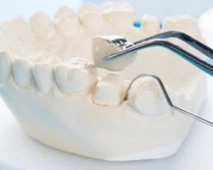 Restorative Dentistry at Mathee Dental Studio, Somerset West