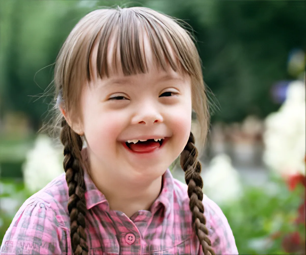 Dental management of Down Syndrome Patients — dental care advice from Mathee Dental Studio, Somerset West